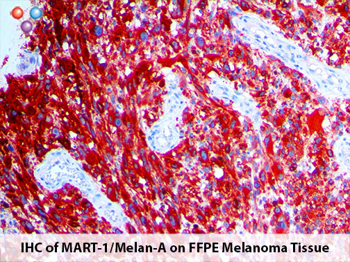 Mart-1 / Melan-A (A103), MMab MAIN