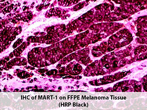 PolyDetector HRP Black Kit MAIN