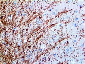Myelin Basic Protein (EP207), RMab MAIN