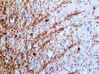 Myelin Basic Protein (EP207), RMab MAIN