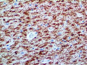 Myelin Basic Protein (Polyclonal), RPab MAIN