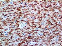 Myelin Basic Protein (Polyclonal), RPab MAIN