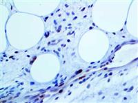 MDM2 (BSB-64), MMab MAIN