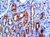 MDR-1 (JSB-1), MMab MAIN