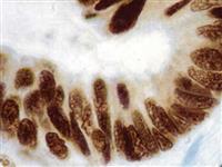 MLH1 (G168-728), MMab MAIN