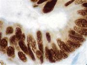 MLH1 (G168-728), MMab THUMBNAIL