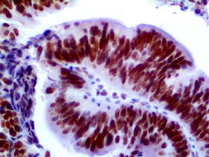 MLH1 (RBT-MLH1), RMab MAIN
