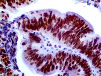 MLH1 (RBT-MLH1), RMab MAIN