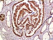 MSH2 (BSB-147), MMab THUMBNAIL