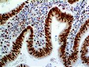 MSH6 (44), MMab THUMBNAIL