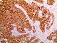 MUC1 (RBT-MUC1), RMab MAIN