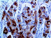 Mammaglobin (EP249), RMab MAIN