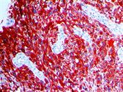 Mart-1 / Melan-A (A103), MMab THUMBNAIL