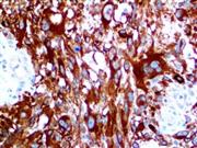 Mart-1 / Melan A (M2-7C10), MMab THUMBNAIL
