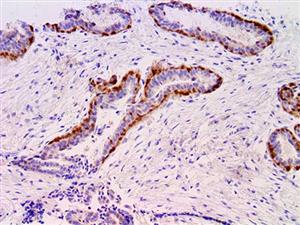 Maspin (BSB-92), MMab MAIN