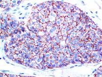 Melanoma KBA.62 (KBA.62), MMab MAIN