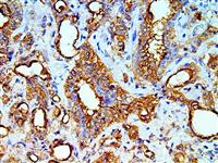 Mesothelial Cell (HBME-1), MMab MAIN