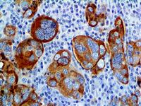 Mesothelin (EP140), RMab MAIN