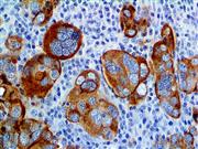 Mesothelin (EP140), RMab THUMBNAIL