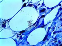 Mycobacterium tuberculosis (Polyclonal), RPab MAIN