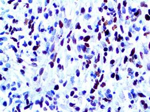 MyoD1 (EP212), RMab MAIN