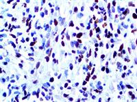 MyoD1 (EP212), RMab MAIN