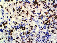 Myogenin (F5D), MMab MAIN