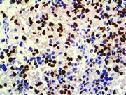 Myogenin (F5D), MMab THUMBNAIL