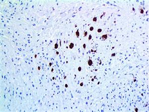 Myoglobin (EP87), RMab MAIN
