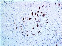 Myoglobin (EP87), RMab MAIN