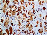 Myoglobin (BSB-104), MMab MAIN