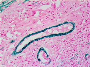 Myosin Smooth Muscle (BSB-17), MMab MAIN