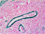 Myosin Smooth Muscle (BSB-17), MMab THUMBNAIL