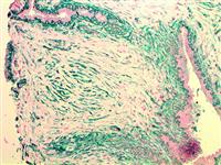 NGFR (BSB-18), MMab MAIN