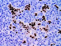 NKX2.2 (EP336), RMab MAIN