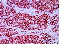 NKX3.1 (EP356), RMab MAIN