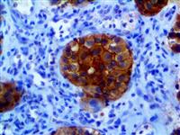 NRAS (RBT-NRAS), RMab MAIN