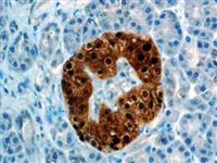 NSE (BSB-94), MMab MAIN