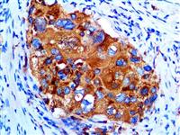 Napsin A (EP205), RMab MAIN