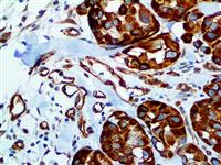 Nestin (EP287), RMab MAIN