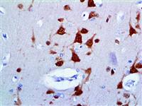 NeuN (A60), MMab MAIN