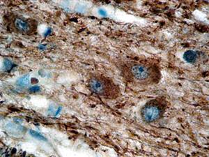 Neurofilament (EP79), RMab MAIN