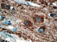 Neurofilament (EP79), RMab MAIN