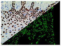 p63 (4A4), MMab MAIN