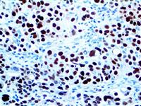 PAX-8 (RM436), RMab MAIN