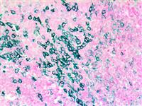 PD-1 / CD279 (EP239), RMab MAIN