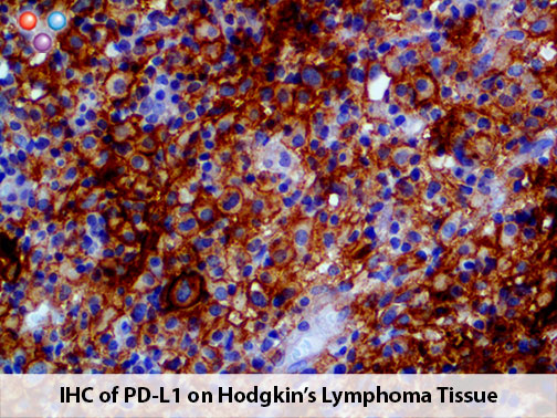 PD-L1 / CD274 (RBT-PDL1), RMab MAIN