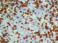 PD-1 / CD279 (NAT-105), MMab MAIN