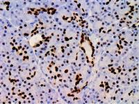 PDX1 (EP139), RMab MAIN