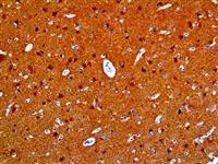 PGP 9.5 (BSB-46), MMab MAIN